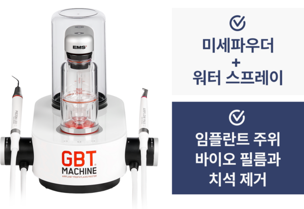 안 아픈 스케일링, 에어플로우 방식